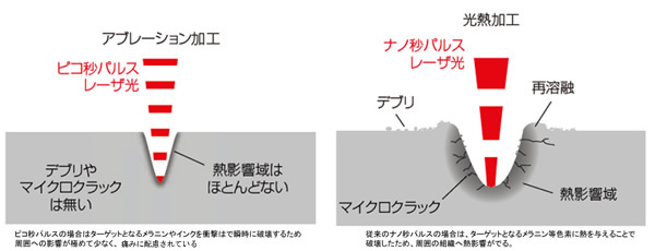 ピコ秒パルス 熱影響層が少ない