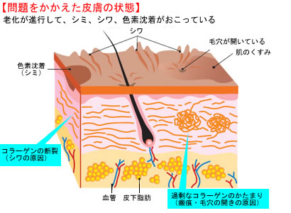 問題をかかえた皮膚の状態