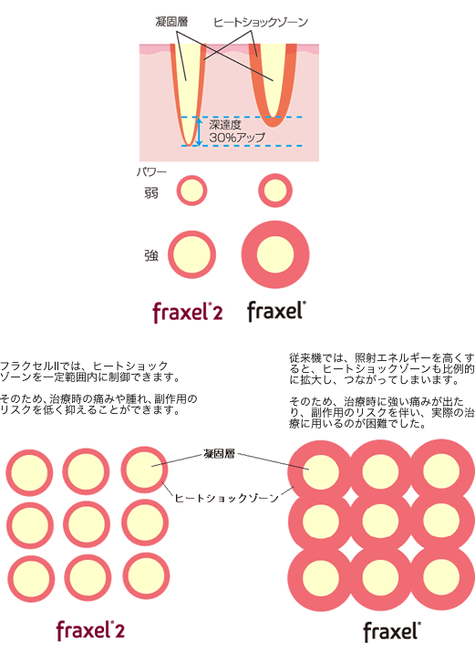 ヒートショックゾーンとは？