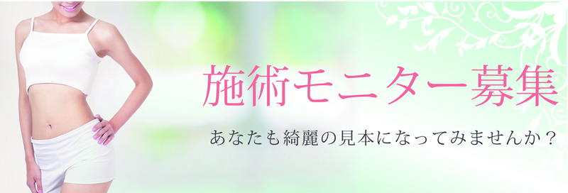 施術モニター募集 最大70%OFF　あなたも綺麗の見本になってみませんか？