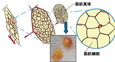 脂肪真珠