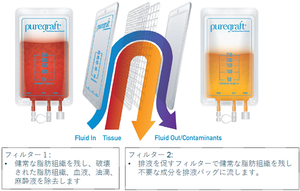 脂肪洗浄フィルター