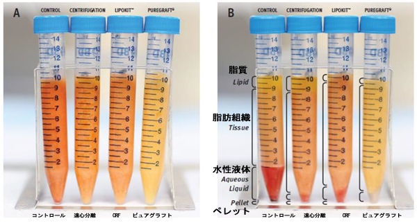 赤血球の含有量の比較