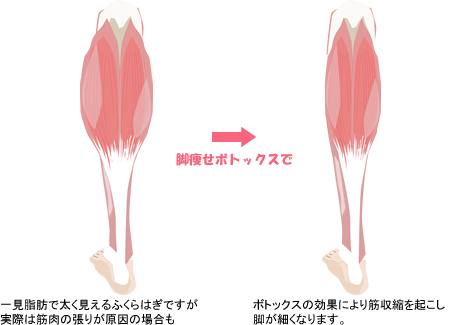 脚の太さはふくらはぎの筋肉？。