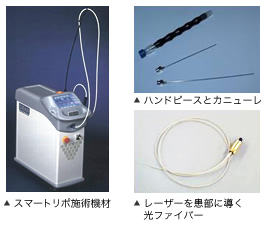 スマートリポ施術機材 ハンドピースとカニューレ レーザーを患部に導く光ファイバー