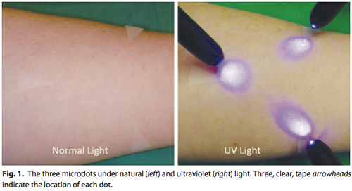 Normal Light UV Light