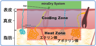 ６０℃の熱溜まり