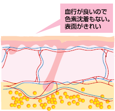 毛根・アポクリン汗腺・エクリン汗腺が綺麗に取れ、血管網は保たれ、色素沈着、血行障害、皮膚の引きつれが少ない。