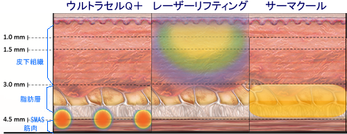 ウルトラセルQプラスと他医療機器の相乗効果