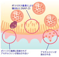 模式図5