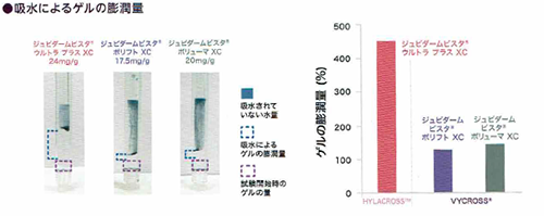 ジュビダームビスタ®ボリフトXC