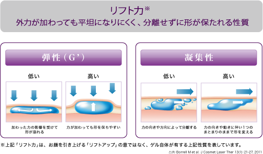 ジュビダームビスタ®ボリューマXC