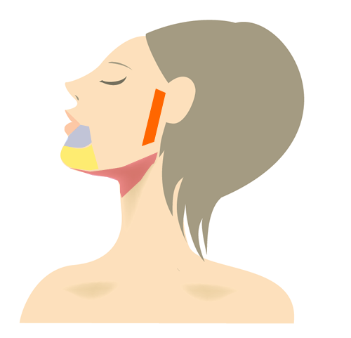 両腕脱毛プラン部位 正面図