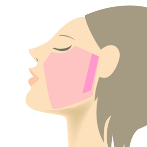 両腕脱毛プラン部位 正面図