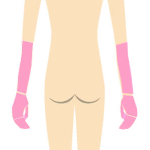 両腕脱毛プラン部位 正面図