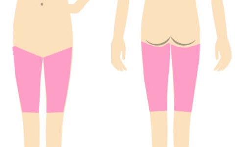 両ふともも