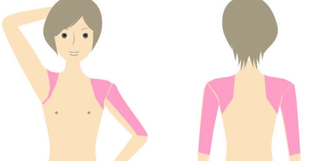 両腕脱毛プラン部位 正面図