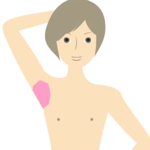 両腕脱毛プラン部位 正面図