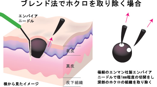 ブレンド法図１