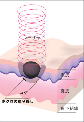 ブレンド法図２