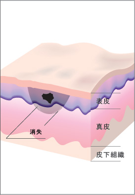 ブレンド法図３