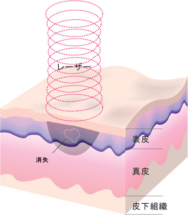 ブレンド法図４